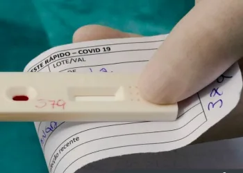 Estado do Rio registra 154 mil casos e 12.654 mortes por covid-19