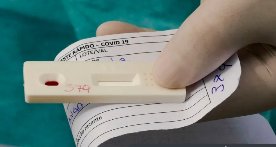 Estado do Rio registra 154 mil casos e 12.654 mortes por covid-19