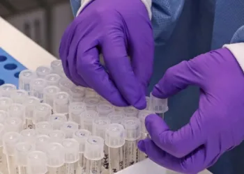 Estado do Rio de Janeiro confirma mais 157 mortes por covid-19