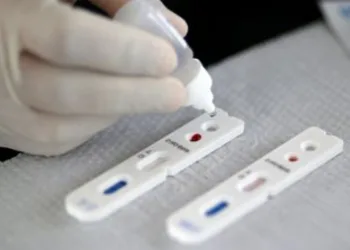 Estado do Rio passa de 160 mil casos do novo coronavírus