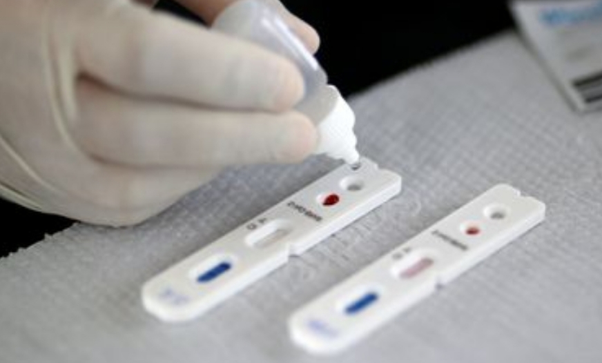 Estado do Rio passa de 160 mil casos do novo coronavírus