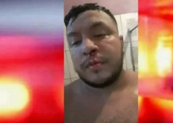 Homem é agredido pela namorada por não postar foto com ela nas redes sociais