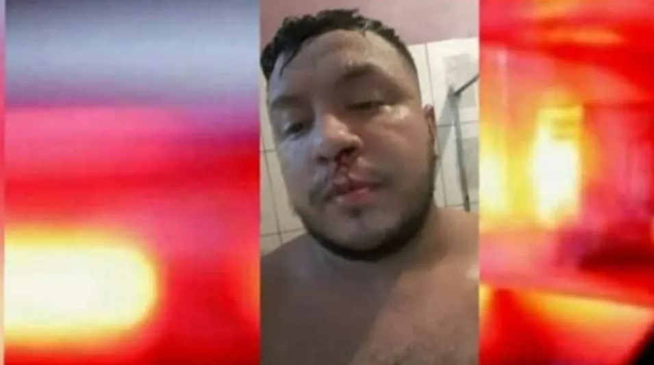 Homem é agredido pela namorada por não postar foto com ela nas redes sociais