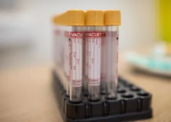 Rio de Janeiro registra mais 140 óbitos por covid-19 em 24 horas