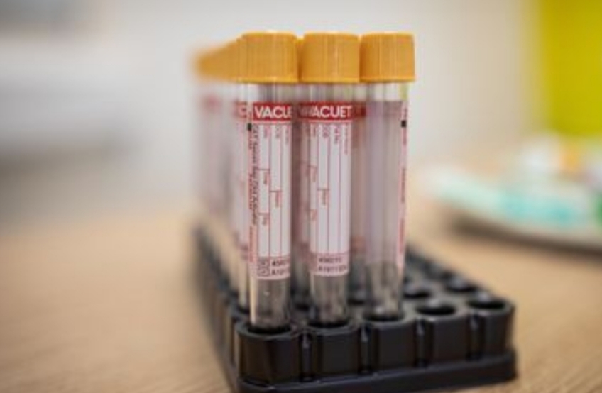 Rio de Janeiro registra mais 140 óbitos por covid-19 em 24 horas