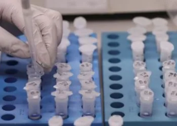 Reinfecções pelo novo coronavírus criam dúvidas sobre imunidade