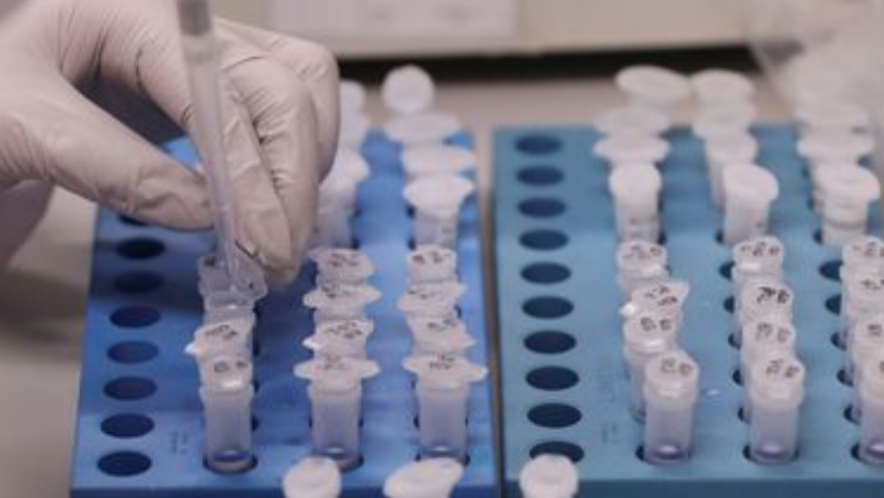 Reinfecções pelo novo coronavírus criam dúvidas sobre imunidade