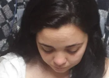 Mulher sofre parada cardiorrespiratória após realizar escova progressiva no cabelo: ‘Não aguentava de dor’