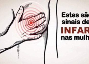 INFARTO FEMININO MATA!! PORQUE É DIFERENTE?