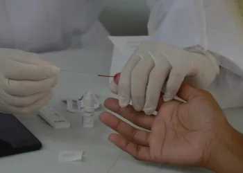 Secretaria Municipal de Saúde (SMS) realiza testagem de covid em Campo Grande