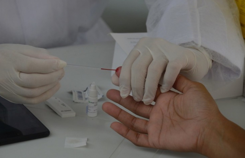 Secretaria Municipal de Saúde (SMS) realiza testagem de covid em Campo Grande