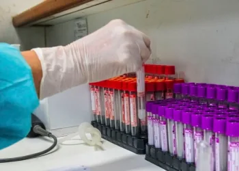 Covid-19: UFRJ desenvolve teste sorológico 20 vezes mais barato