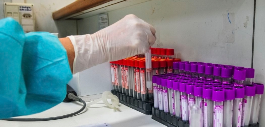 Covid-19: UFRJ desenvolve teste sorológico 20 vezes mais barato