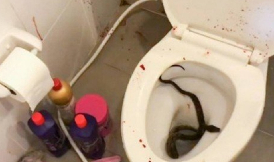 Cobra pica jovem no pênis após ele sentar no vaso sanitário