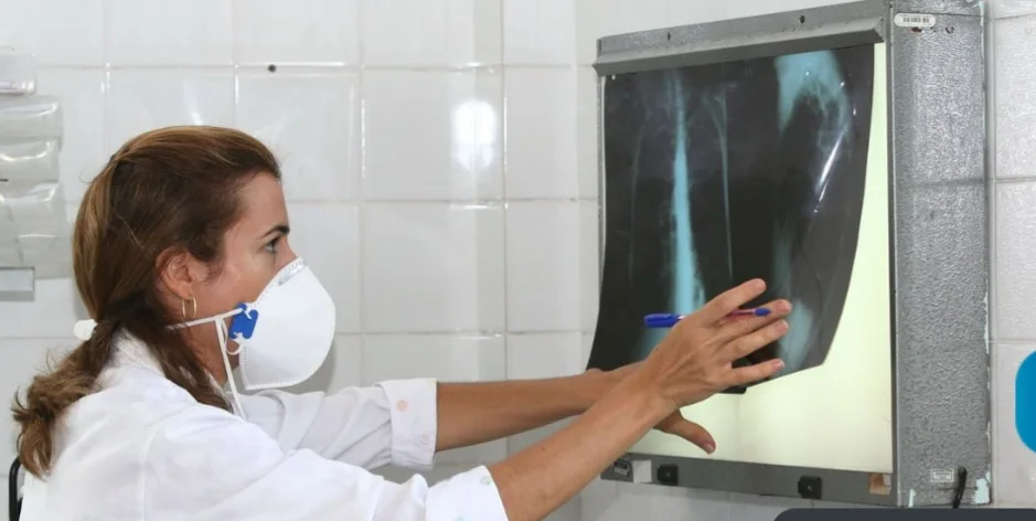 Fiocruz vai testar eficácia da vacina contra tuberculose para covid-19