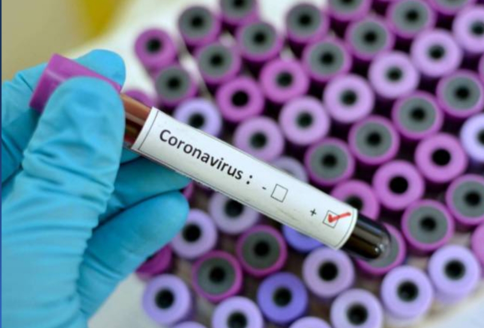 Fiocruz e Instituto D’or comprova que coronavírus é capaz de invadir cérebro