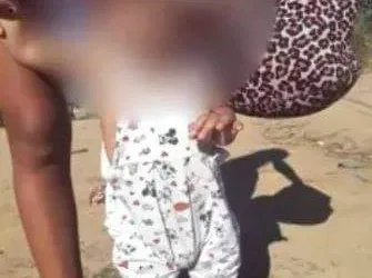 CONTINUA EM ESTADO GRAVE BEBÊ QUE SOFREU AGRESSÕES NO RJ