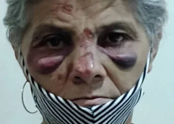 Idosa sofre assalto em Bangu, é espancada, filha vai ajudar e é assaltada por outros bandidos