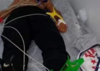 CRIANÇA LEVA DESCARGA ELÉTRICA DE 220 V NO RJ