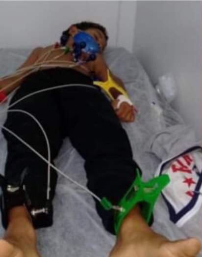 CRIANÇA LEVA DESCARGA ELÉTRICA DE 220 V NO RJ