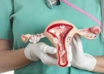 Câncer de ovário; Veja os sintomas, prevenção e tratamento.