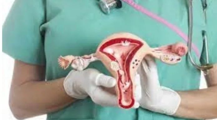 Câncer de ovário; Veja os sintomas, prevenção e tratamento.