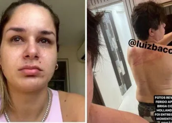 Pamella Holanda se revolta com fotos de DJ Ivis ferido: ‘Nunca vi ele assim’