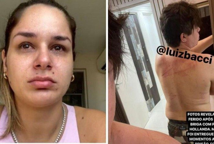 Pamella Holanda se revolta com fotos de DJ Ivis ferido: ‘Nunca vi ele assim’