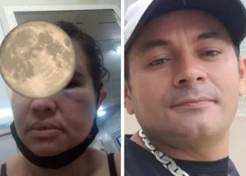 Esposa do homem que bateu de carro de frente com o BRT, relata agressões antes do acidente.