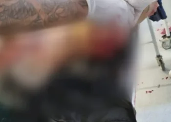 IMAGENS FORTES!!! Médica e enfermeira de UPA,  desmaiam quando corpos de traficantes  chegam mortos na unidade.