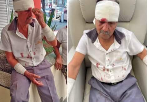 MOTORISTA DE ÔNIBUS É AGREDIDO NO RJ