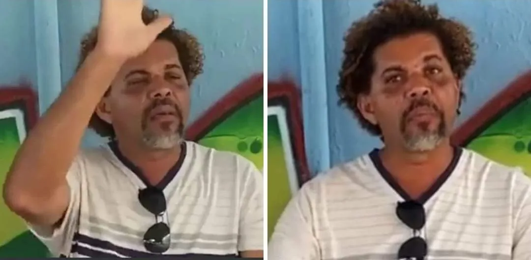 MORADOR DE RUA AGREDIDO POR PERSONAL FALA PELA 1° VEZ: “NÃO ME ARREPENDO”