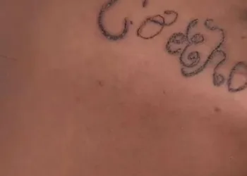 Mãe registra boletim de ocorrência após filha desaparecida aparecer com marca estranha no rosto
