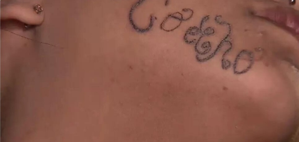 Mãe registra boletim de ocorrência após filha desaparecida aparecer com marca estranha no rosto