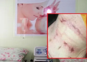 Polícia Civil investiga médica e fisioterapeuta por erros em procedimentos estéticos no RJ