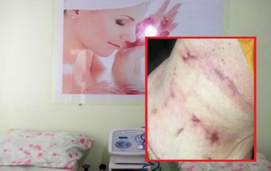 Polícia Civil investiga médica e fisioterapeuta por erros em procedimentos estéticos no RJ