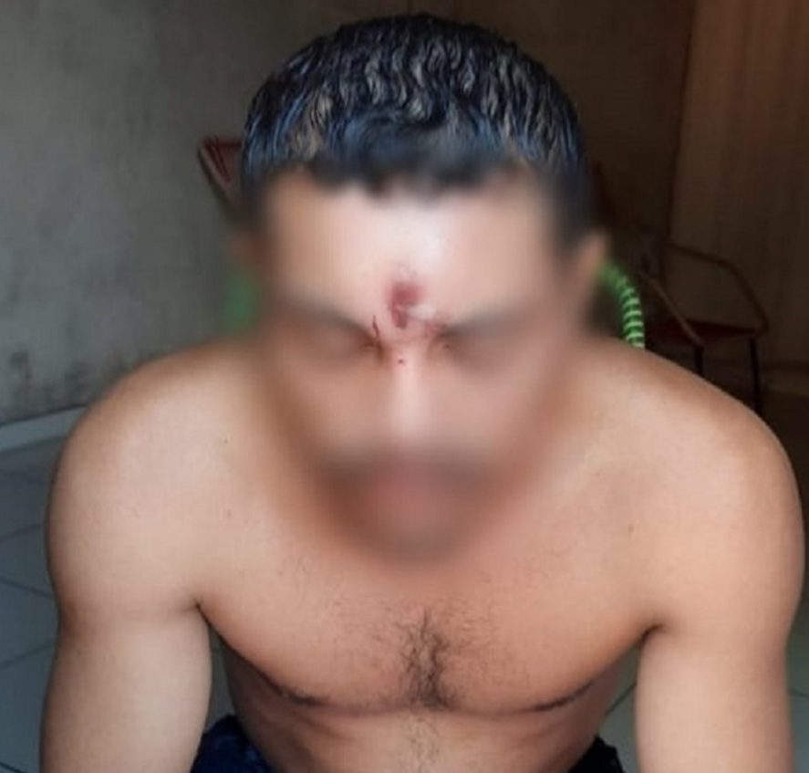 Homem leva tiro na testa, cai de moto e vai para casa dormir