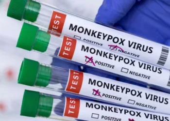 Exame descarta caso de varíola dos macacos no Rio de Janeiro