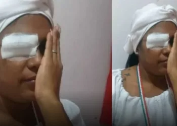 Manicure diz que perdeu um olho ao ser atacada por vizinho por ouvir ‘música de macumba’, no RJ