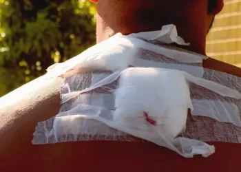 Homem é baleado mesmo após entregar pertences em assalto na Zona Oeste