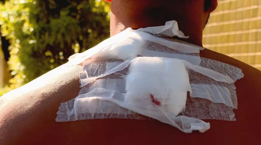 Homem é baleado mesmo após entregar pertences em assalto na Zona Oeste