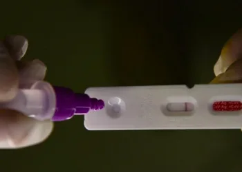 Pesquisadores identificam método capaz de prever gravidade da covid-19