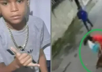 Video forte: Criança tem perna dilacerada por pitbull no RJ
