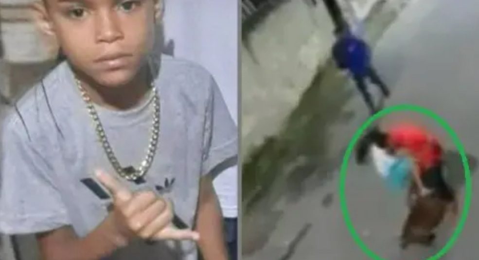 Video forte: Criança tem perna dilacerada por pitbull no RJ