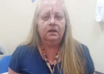( FOTOS) MÉDICA É AGREDIDA EM HOSPITAL NA ZONA OESTE!!