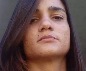 JOVEM QUE TEVE CORPO ATEADO POR FOGO PELO MARIDO NO RJ, NÃO RESISTIU OS FERIMENTOS E VEIO A ÓBITO