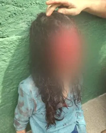 Mulher é agredida com chave inglesa pelo ex-marido e perde parte da orelha no RJ