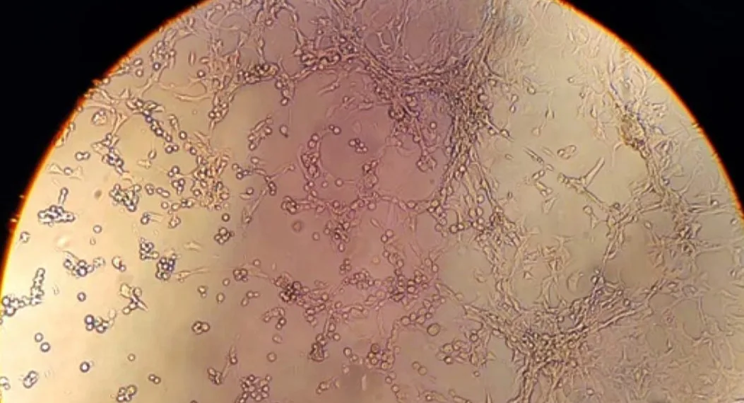 Rio registra 1.270 casos de varíola dos macacos