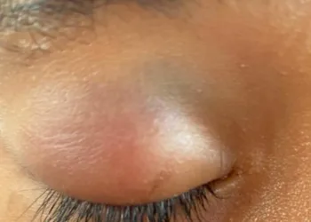 A agressão sofrida por sua filha dentro de uma escola foi registrada na polícia pela mãe