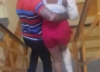 Mulher tem pé e braço fraturados pelo namorado durante briga